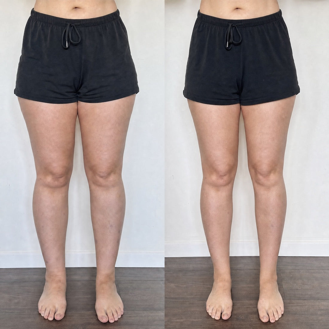 Legs before and after thirty days