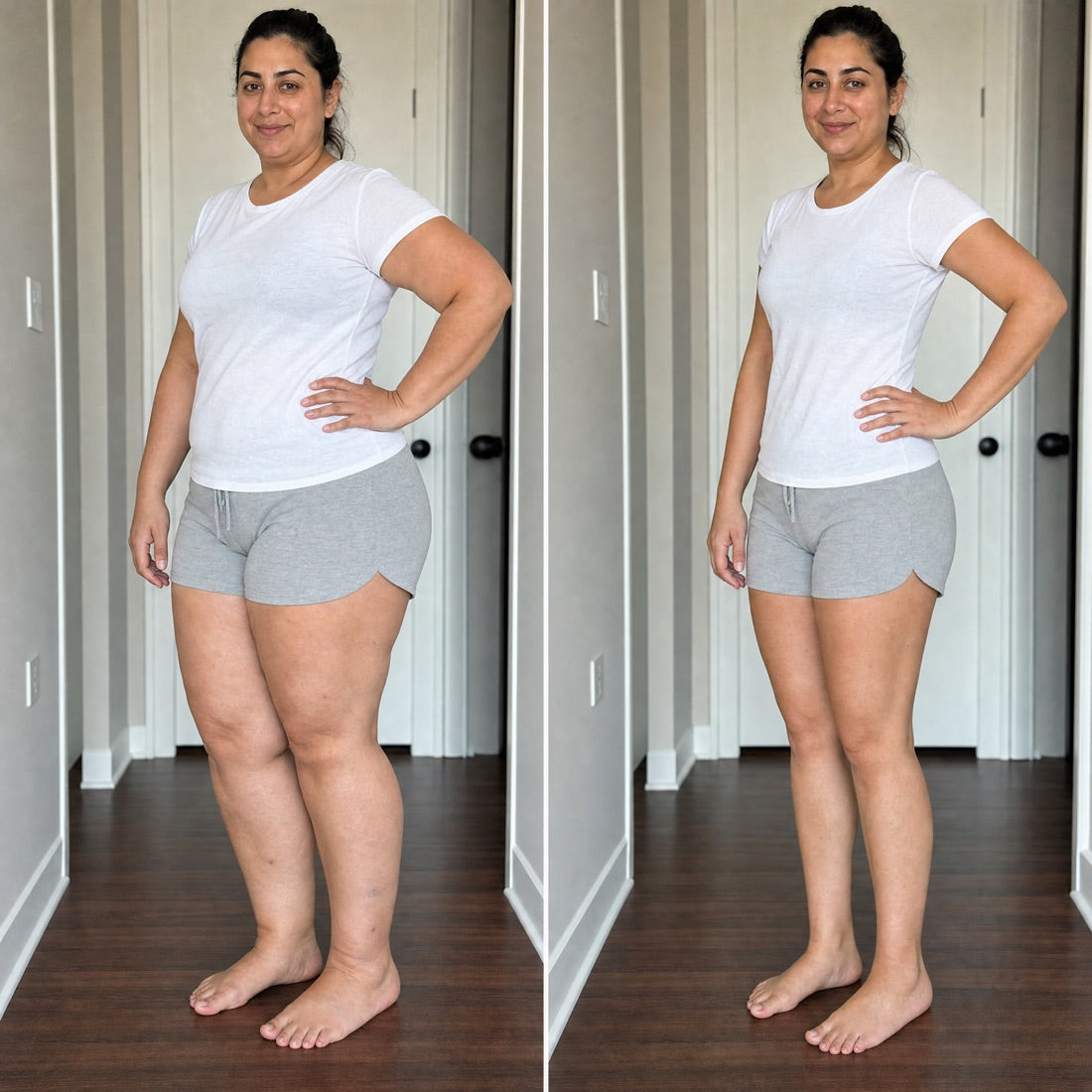 Legs before and after thirty days